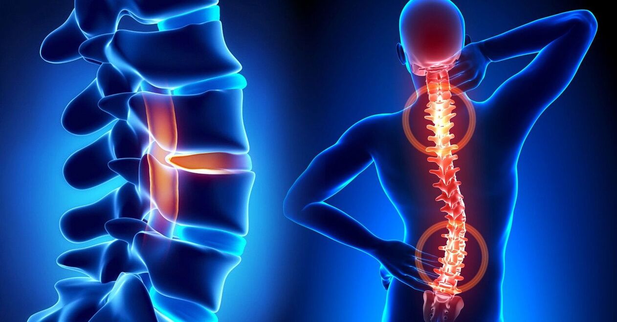 an unhealthy spine leads to neck problems