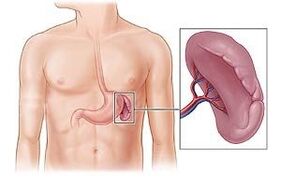 spleen pathology as a cause of pain under the left shoulder blade