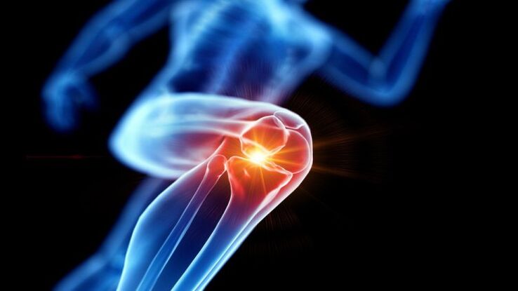 knee joint osteoarthritis